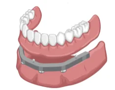 Denturologie Ranger