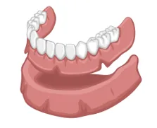denturologie Ranger