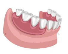 Denturologie Ranger