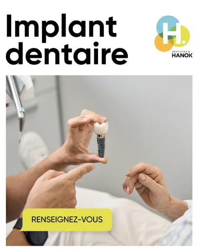 Hanok - Dental implant